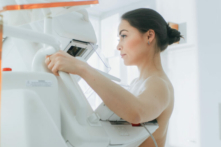 Một người phụ nữ đang được chụp nhũ ảnh. (Ảnh: Gorodenkoff/Shutterstock)