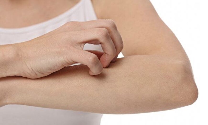 Huyệt Khúc Trì, Kiên Ngung, Huyết hải và Tam âm giao là những huyệt vị đặc biệt giúp giảm ngứa da.(Shutterstock)
