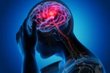 (Ảnh: Peterschreiber.media/ Shutterstock)