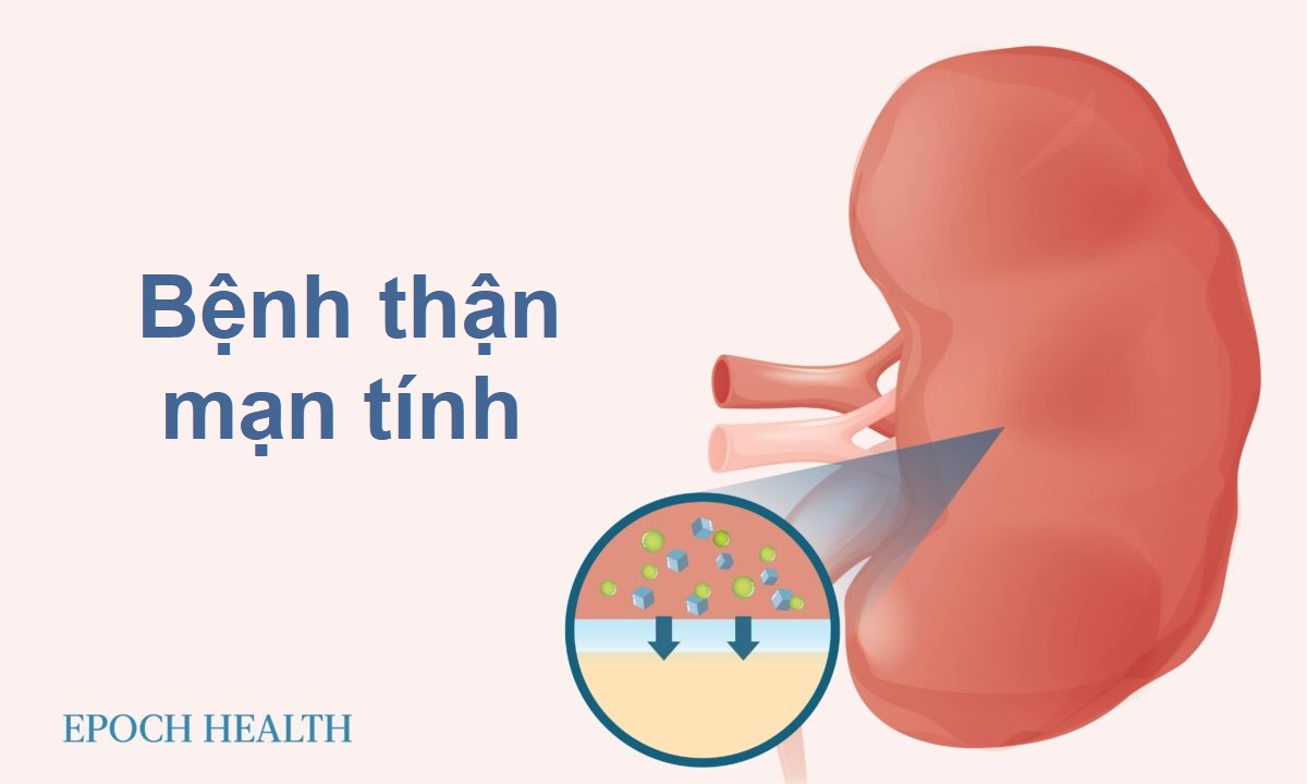Bệnh thận mạn tính: Triệu chứng, nguyên nhân, phương pháp điều trị và liệu pháp tự nhiên
