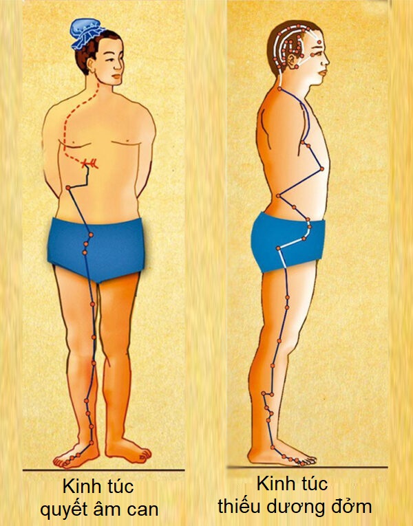 4 giải pháp cho nguyên nhân gốc rễ của chứng đau nửa đầu
