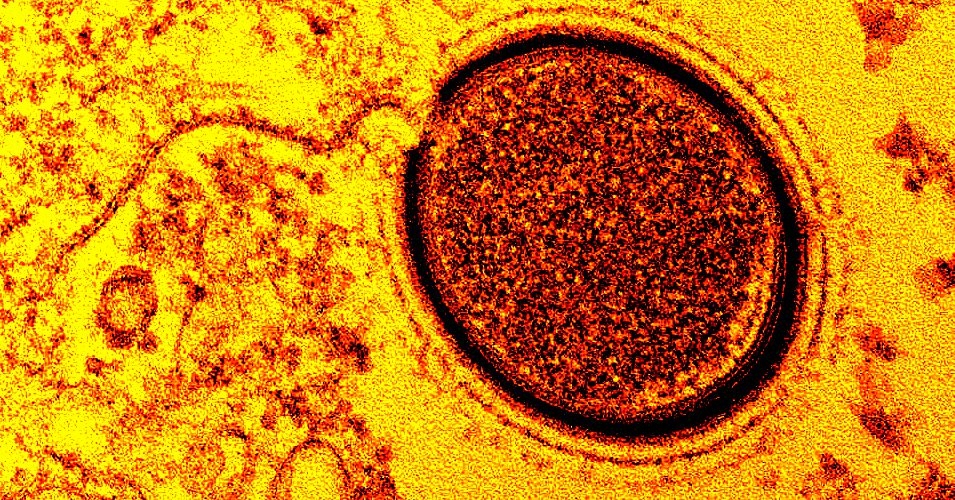 Mollivirus Sibericum. (Ảnh: Deirdre Fulton/Commons.wikimedia)