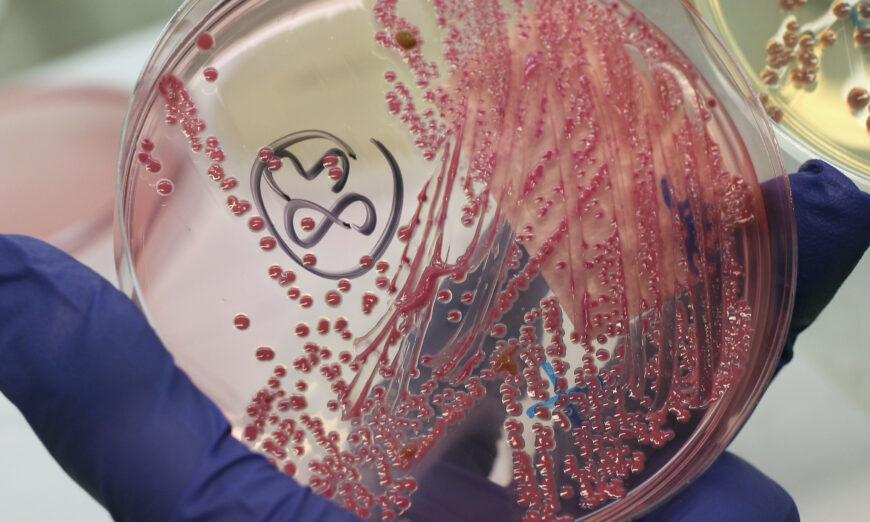 San Diego đề nghị cư dân ở một số khu vực đun sôi nước sau khi phát hiện vi khuẩn E. Coli
