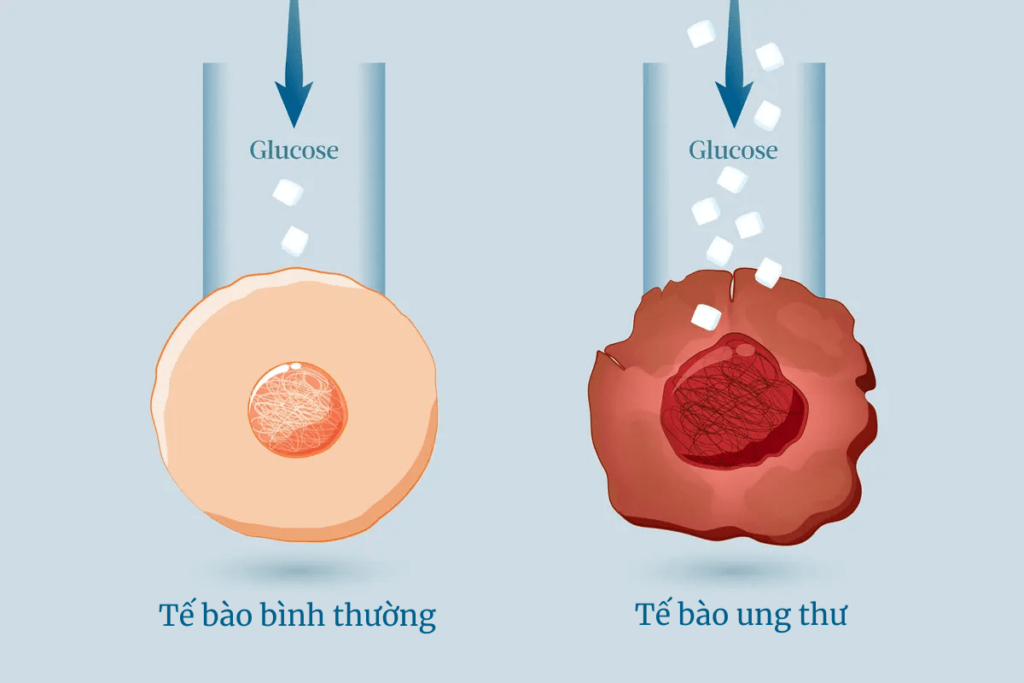 Tế bào ung thư tiêu thụ đường với tốc độ nhanh hơn 200 lần so với tế bào bình thường