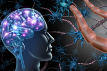 Để ngăn ngừa bệnh Alzheimer, mọi người nên bắt đầu từ 20 năm trước khi các triệu chứng xuất hiện. (Ảnh: CGN089/Shutterstock)