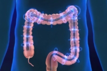 (Ảnh: picmedical/Shutterstock)