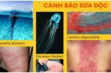 Việt Nam: Cảnh báo sứa lửa ở vùng biển Nha Trang gây nguy hiểm